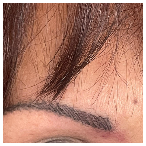 formation-esthetique-le-cannet